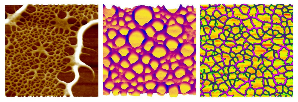 Auto-assemblage et auto-organisaton de collagène à l’interface solide/liquide
