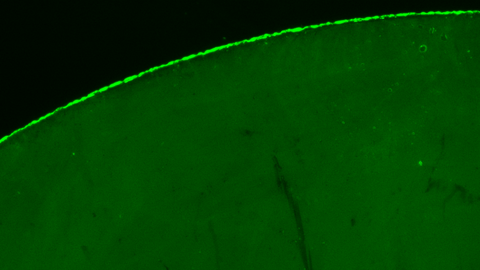 Microscope à fluorescence d’anticorps fluorescents sur une lame de verre Image de microscope à fluorescence montrant une immobilisation homogène d’anticorps sur une lame de verre